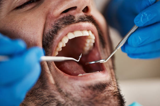 Best Emergency Treatment for Dental Infections or Abscesses in Poplar Bluff, MO
