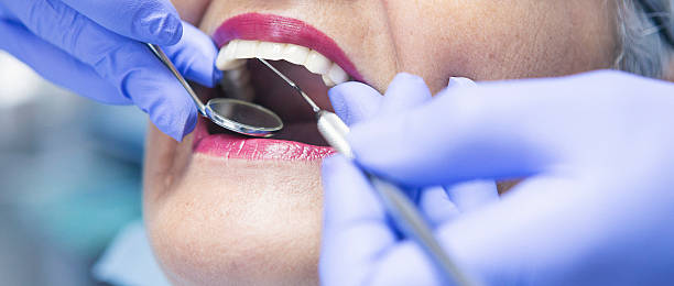 Best Emergency Dental Care for Broken or Chipped Teeth in Poplar Bluff, MO